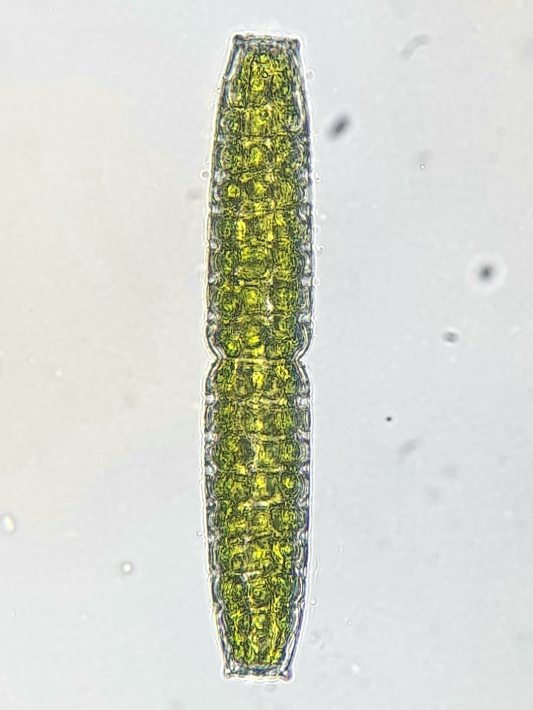 Pleurotaenium verrucosum (Pleurotaenium verrucosum)
