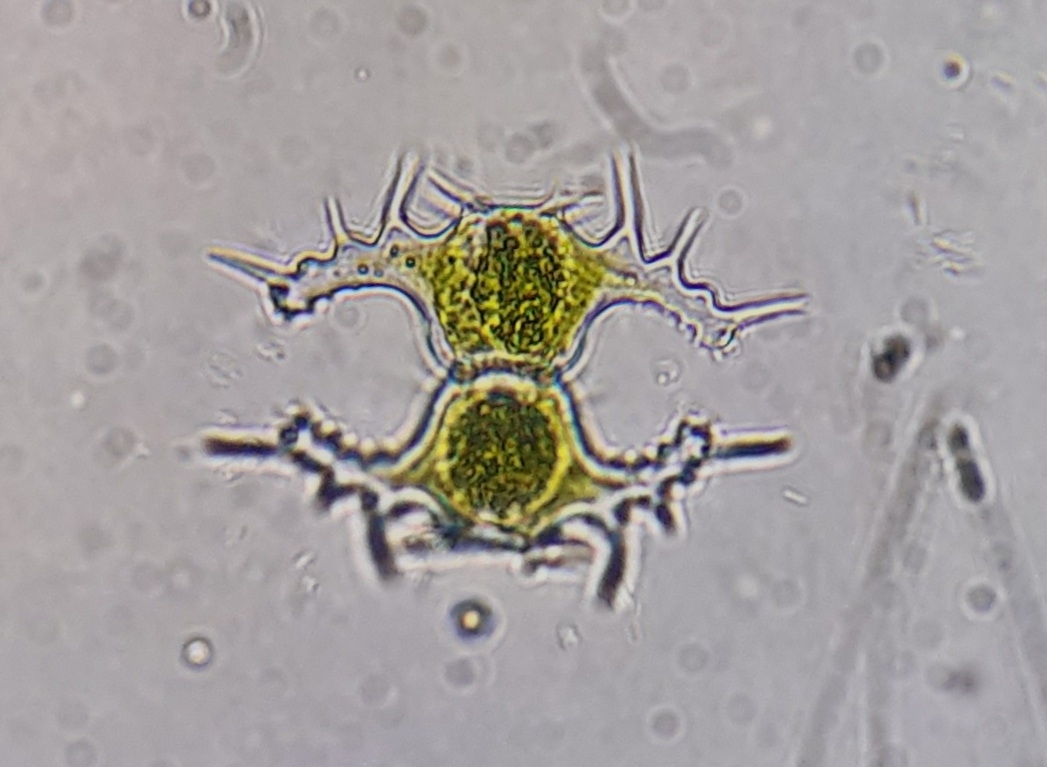 Staurastrum saltans (Staurastrum saltans)