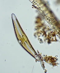 Cymbella