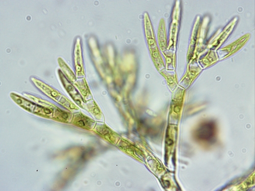 Representative image of Chaetophoraceae