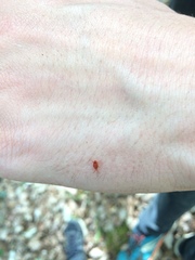 Trombidium holosericeum