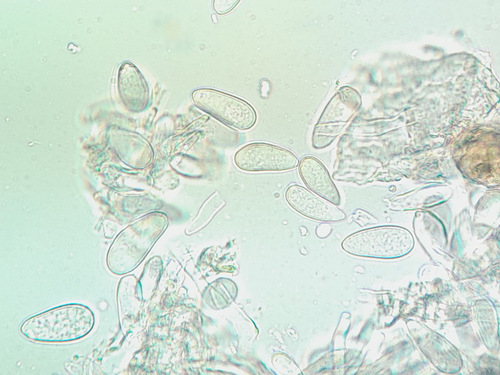 Ramularia rubella