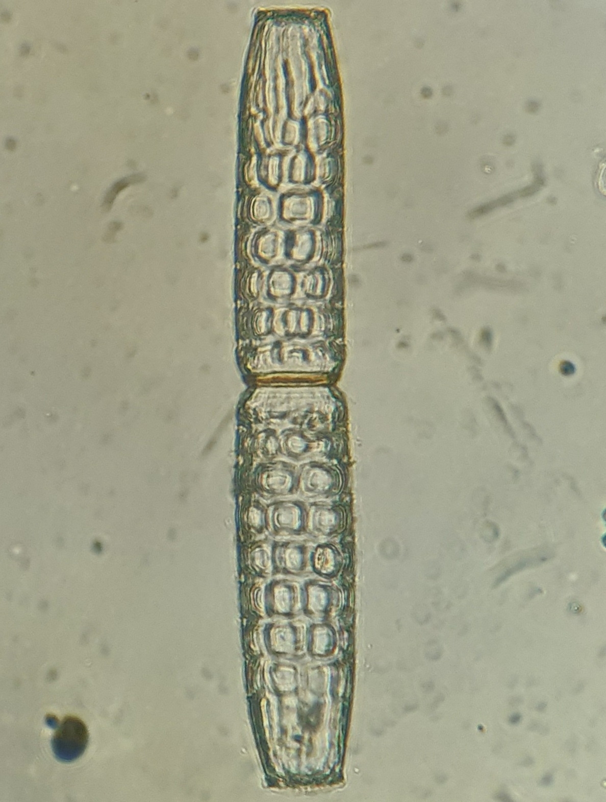 Pleurotaenium verrucosum — ảnh 2