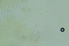 Radulomyces confluens