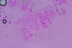 Radulomyces confluens