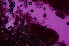 Colletotrichum dracaenophilum