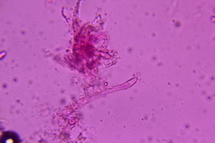 Colletotrichum dracaenophilum
