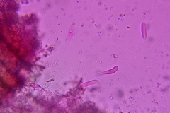 Colletotrichum dracaenophilum