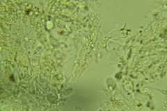 Eichleriella macrospora