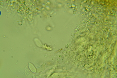 Eichleriella macrospora