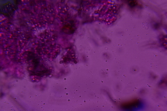 Byssocorticium caeruleum