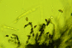 Anthostomella