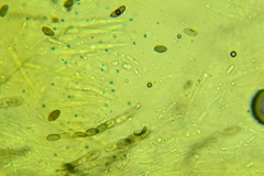 Anthostomella