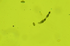 Anthostomella