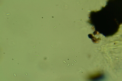 Anteaglonium globosum