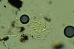 Anteaglonium globosum