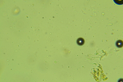 Hyphodermella rosae