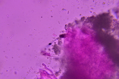 Hyphodermella rosae