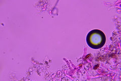Hyphodermella rosae