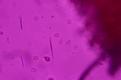 Hyalotrochophora lignatilis