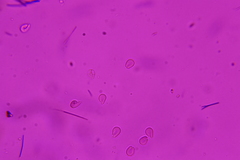 Hyalotrochophora lignatilis