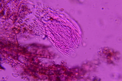 Hyalotrochophora lignatilis