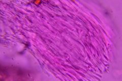 Hyalotrochophora lignatilis
