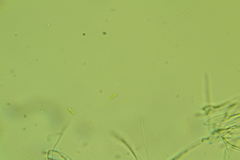 Arachnopeziza trabinelloides
