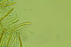 Arachnopeziza trabinelloides