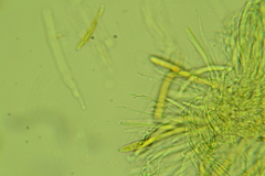Arachnopeziza trabinelloides