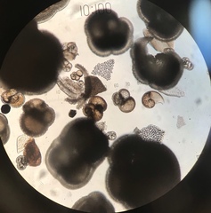 Globigerina