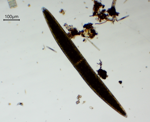 Closterium pritchardianum