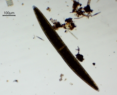Closterium pritchardianum