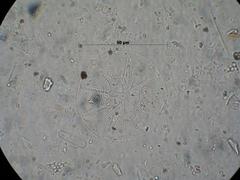 Asteromphalus