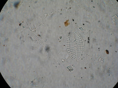 Cocconeis