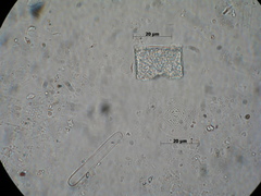 Eucampia