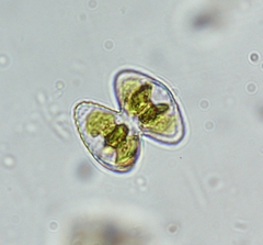 Staurastrum punctulatum