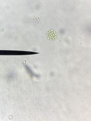 Lacunastrum gracillimum