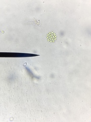 Lacunastrum gracillimum