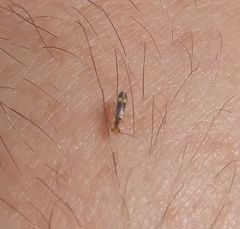 Malthinus occipitalis