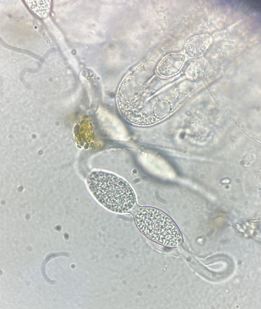 Zygospermella