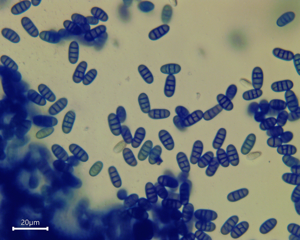 Pseudocamarosporium brabeji from Huntsbury, Christchurch 8022, New ...