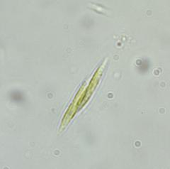 Elakatothrix