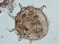 Centropyxis aculeata