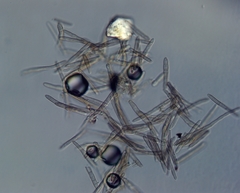 Pseudocercospora nogalesii