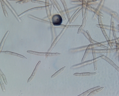 Pseudocercospora atromarginalis
