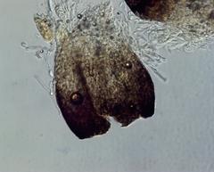 Sphaerellopsis filum