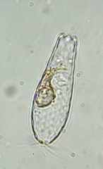 Euglypha cristata