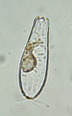 Euglypha cristata