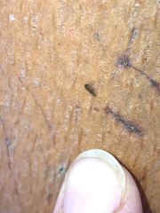 Ctenarytaina longicauda